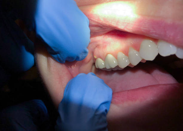 Best Emergency Dentist Near Me  in Savoy, IL